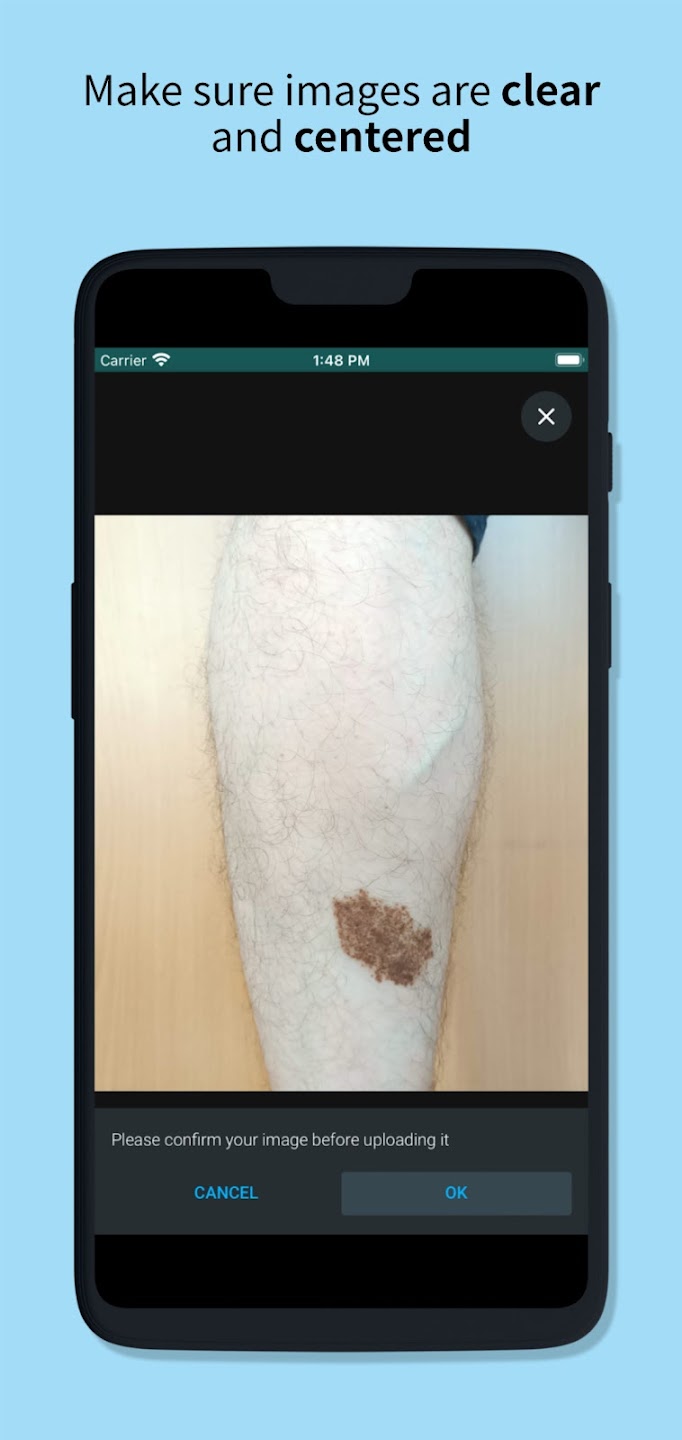 Skin Check: Dermatology App